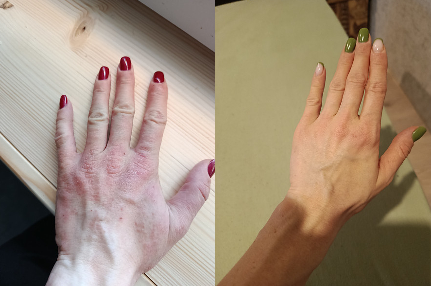 Bioderma emolientas
